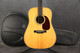 Martin HD-28 - 2nd Hand