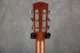 Alvarez Laureate LP70e Daybreak - 2nd Hand