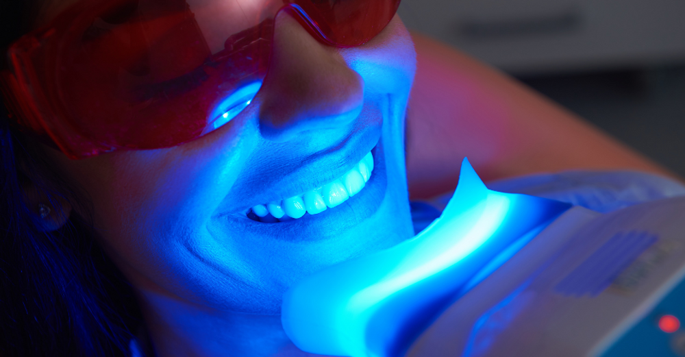 10 Curiosità Affascinanti sullo Sbiancamento dei Denti che Probabilmente Non Conosci