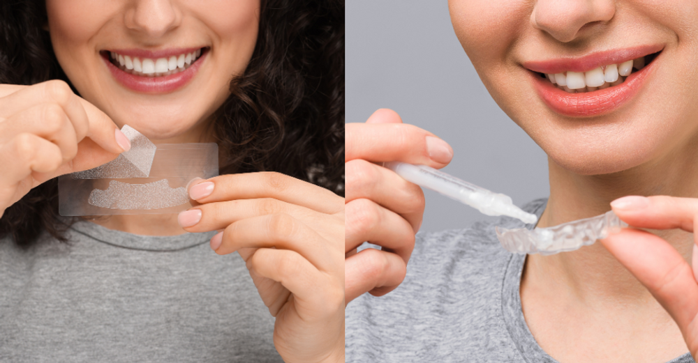 Strisce sbiancanti vs. gel sbiancanti - Qual è il metodo più efficace?
