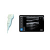 Portable B/W Handhold Linear Scanner Ultrasound Probe Medical Instruments For Android Tablet Computer