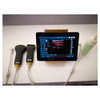 Mini Type C USB Color USG Linear/Con Vex Doppler Ultrasound Machine
