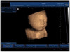 3D Image Function PC Based 15 Inch Notebook B Ultrasound Scanner Machine