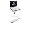 3D Image Function PC Based 15 Inch Notebook B Ultrasound Scanner Machine