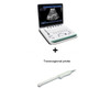 3D Image Function PC Based 15 Inch Notebook B Ultrasound Scanner Machine