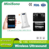 Handheld Wireless Ultrasound Super width Linear Ultrasound Build in 5G wifi