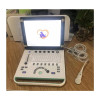 Veterinary Portable 3D Ultrasound Scanner USG with VGA port to connect to TV directly SS-9 Vet Use