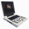 12 Inch LED Screen 3D Notebook Color Doppler Echo Ultrasound Diagnosis Scanner Machine