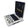 12 Inch LED Screen 3D Notebook Color Doppler Echo Ultrasound Diagnosis Scanner Machine