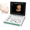 15 inch SS-9 LCD Notebook Ultrasound Scanner USG B&W 3D Image Function PC based Free Shipping