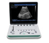 15 inch SS-9 LCD Notebook Ultrasound Scanner USG B&W 3D Image Function PC based Free Shipping
