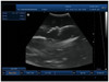 15 inch SS-9 LCD Notebook Ultrasound Scanner USG B&W 3D Image Function PC based Free Shipping