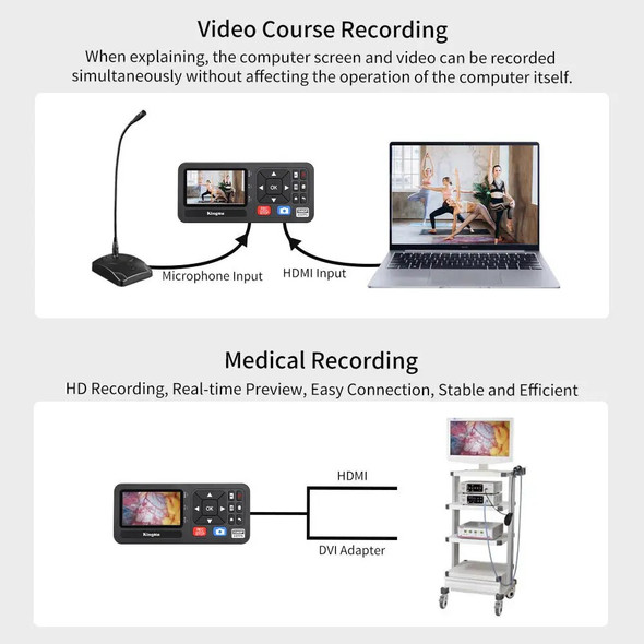 KingMa HDMI Video Converter Capture and Stream Video from DVD RCA VHS to the Digital Converter Box for Recording