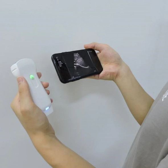 Wireless Color Ultrasound Color Doppler 3 in 1 Probe Convex Linear Phased Array Probe support iOS Android Windows WIFI