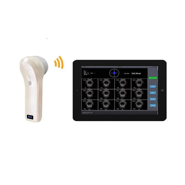 Medical Equipment Wifi Portable Handheld 4D Wireless Probe Bladder Ultrasound Scanner