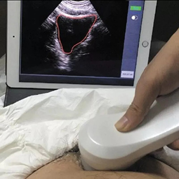 Medical Equipment Wifi Portable Handheld 4D Wireless Probe Bladder Ultrasound Scanner