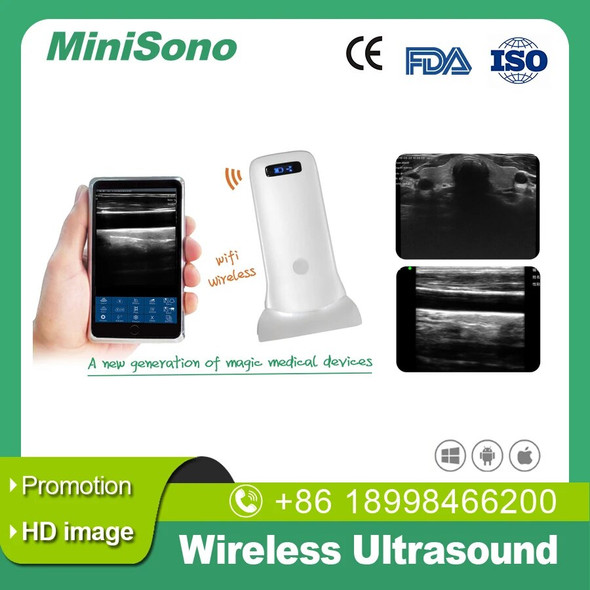 Handheld Wireless Ultrasound Super width Linear Ultrasound Build in 5G wifi