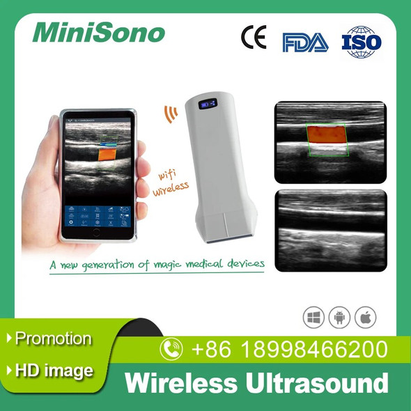 Mini Ultrasound Wireless 192E Linear portable Ultrasound 5G wifi