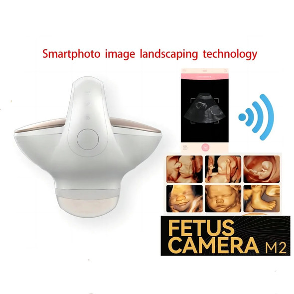 3D 4D Wireless ultrasound Pregnant woman fetal imaging device ultrasound Smart fetus camera imaging system wifi Android ios