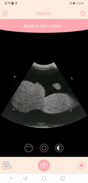 3D 4D Wireless ultrasound Pregnant woman fetal imaging device ultrasound Smart fetus camera imaging system wifi Android ios