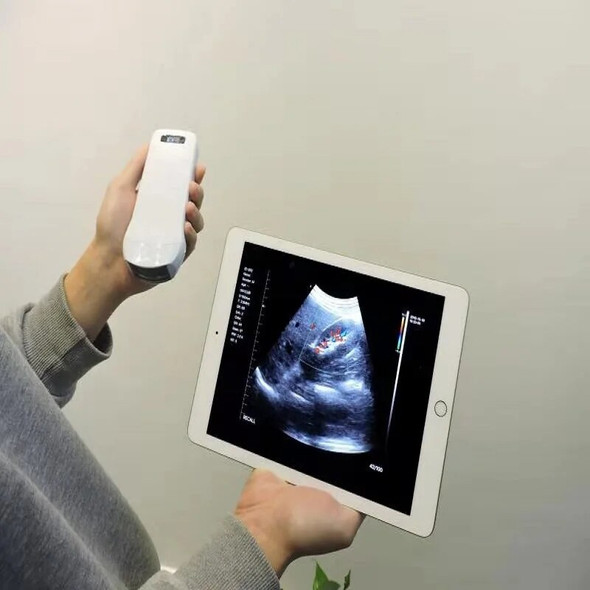 3-in-1 Ultrasound Probe Wifi for IOS Android Windows System Wireless Convex, Linear, Micro-convex