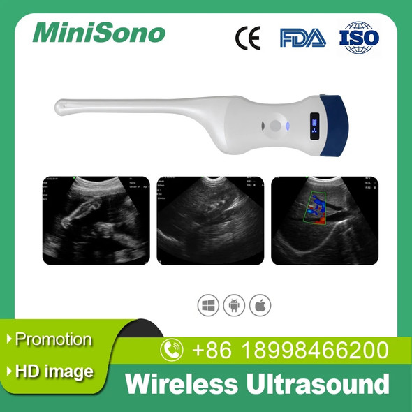 Wireless Ultrasound Color Doppler Dual Head Convex Transviginal Probe 5G WiFi…