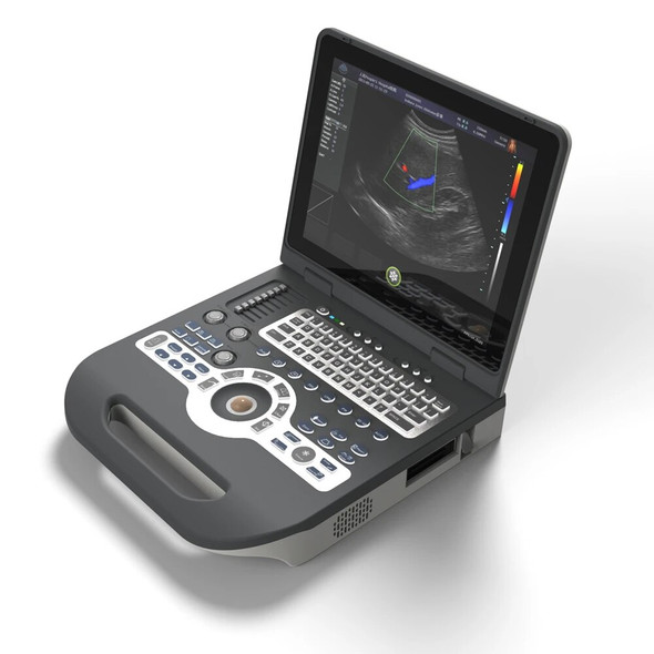 15inch Led 2D 3D 4D 128 Elements Notebook Ultrasound Scanner Color Doppler Machine