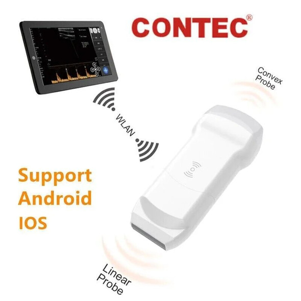 CONTEC CMS1600A Handheld WiFi Wireless Color Doppler Ultrasound Scanner Dual probe CONTEC CMS1600A Handheld WiFi Wireless Color Doppler Ultrasound Scanner Dual probe