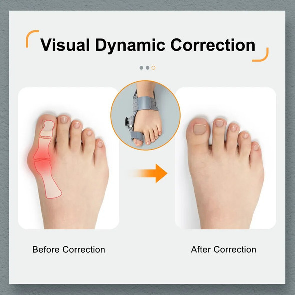 Bunion Corrector Adjustable Hallux Valgus Big Toe Corrector Rotatable Toe Corrector Straightener Adjustable Toe Correction