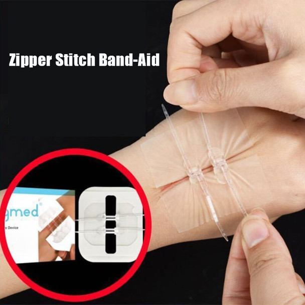 2Pcs Zipper Tie Wound Closure Patch Zipper Band Aid Wound Fast Suture