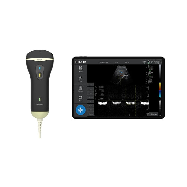 Healson Portable Real Time Color Doppler Ultrasound Scanner M40C For Hospital Clinic Medical Equipment