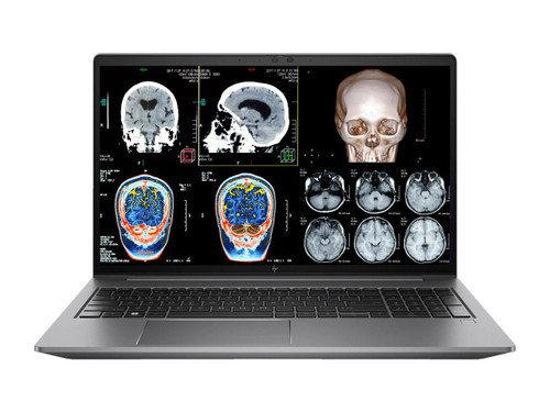 Refurbished HP ZBook Studio G8 i7-11850H 15.6 mobile workstation laptop with Nvidia T1200 graphics, displaying medical imaging scans...
