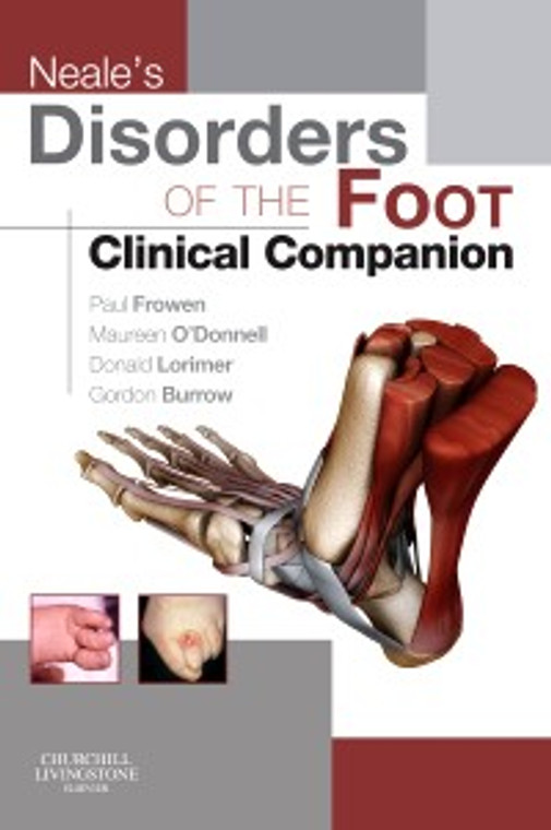 Neal'es Disorders of the Foot: Clinical Companion