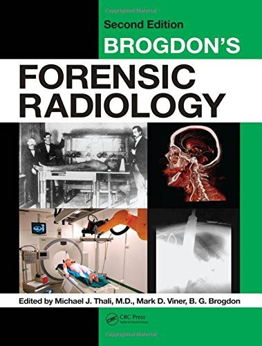 Fisher Paykel 575717 Brogdon's Forensic Radiology, Second Edition [Hardcover] [2010] (Author) Michael J. Thali M.D., Mark D. Viner, B.G. Brogdon