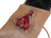 Techline Gunshot Wound Bicep