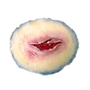 Techline Trauma Laceration Wound - Medium