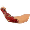  TOMManikin Burn Left Arm