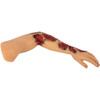  TOMManikin Burn Left Arm
