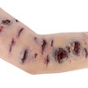 TOMManikin Shrapnel Injury Right Arm