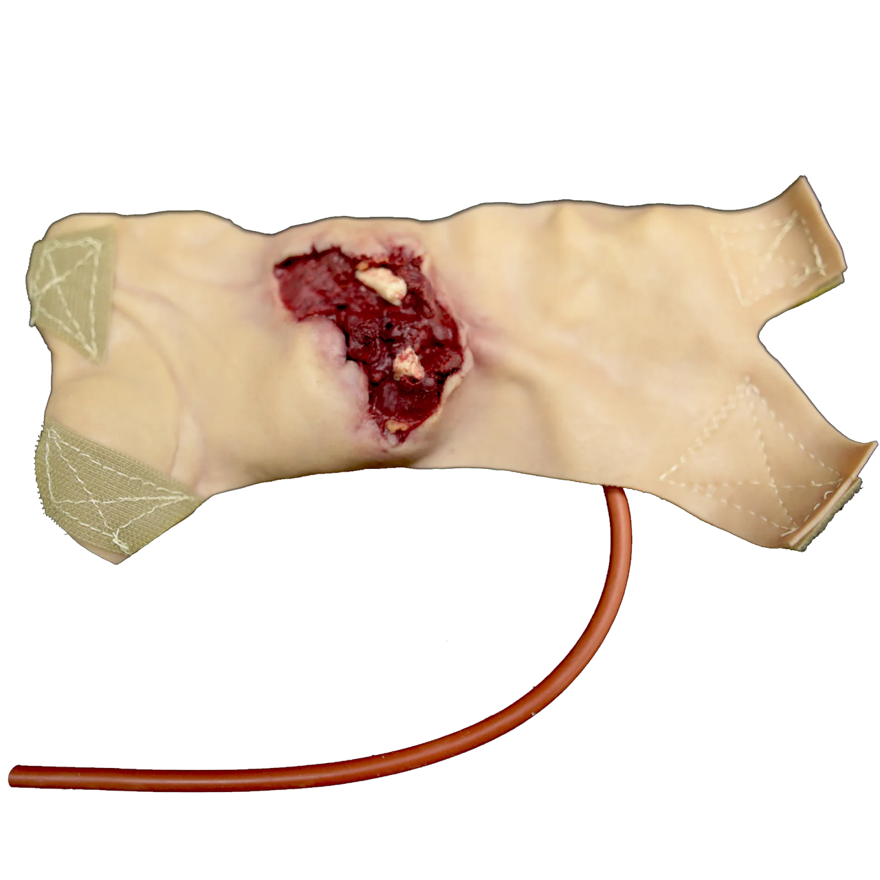 Techline Gunshot Wound Through Hand - Left