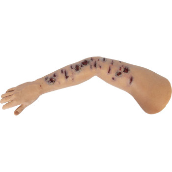 TOMManikin Shrapnel Injury Right Arm