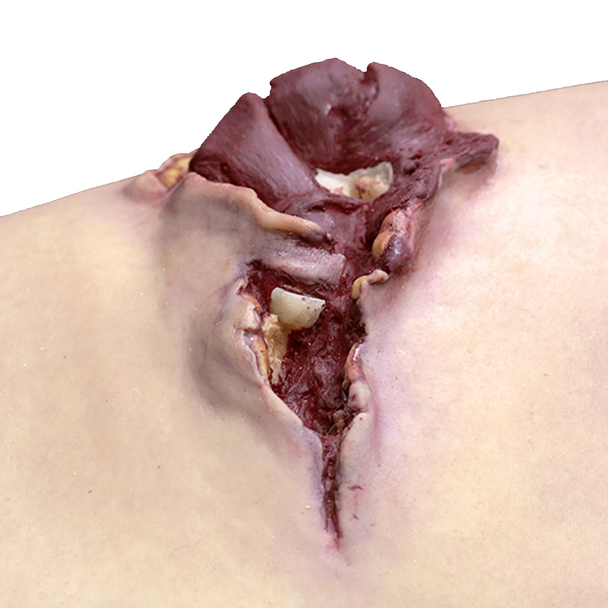 Techline Gunshot Wound Bicep