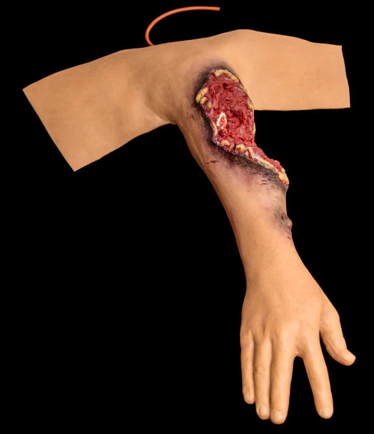 Techline Trauma Partial Arm Amputation (Right)