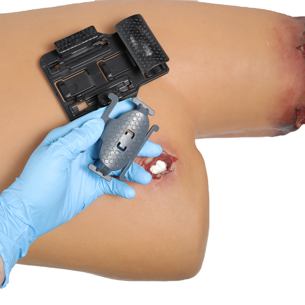 6:8 Medical Advantage Pressure Bar Set