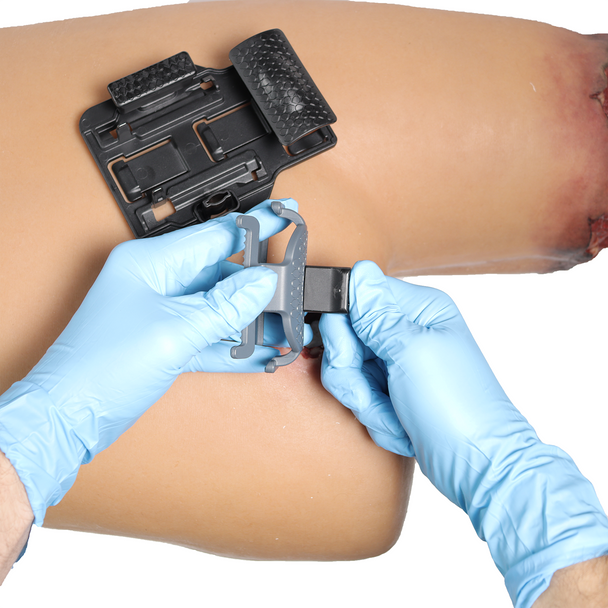 6:8 Medical Advantage Pressure Bar Set