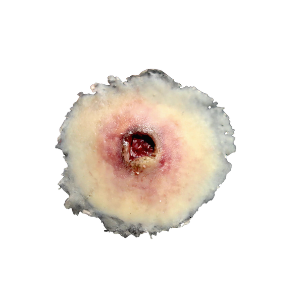 Techline Trauma Gunshot Entry Wound - Small