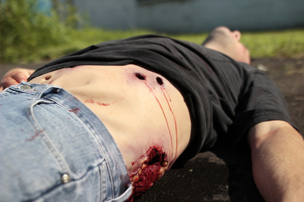 Techline Multiple Gunshot Abdomen