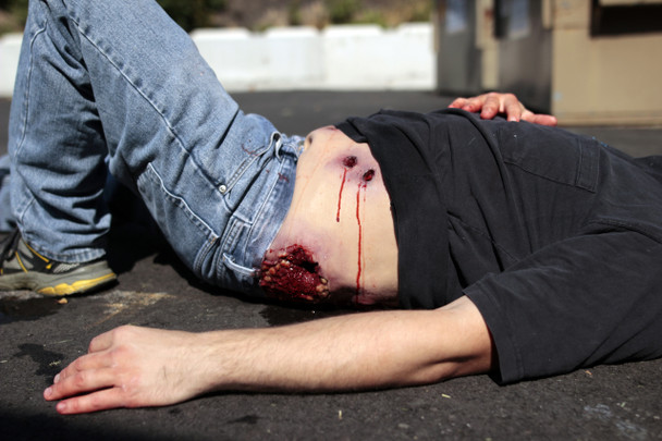 Techline Multiple Gunshot Abdomen