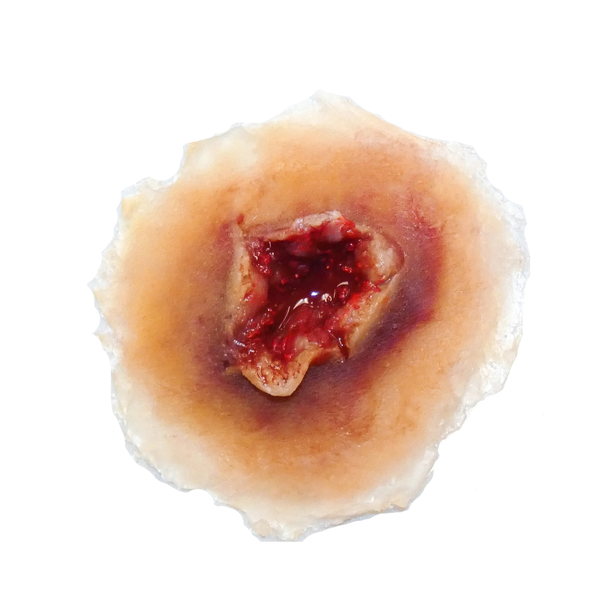 Techline Trauma Gunshot Exit Wound - Medium