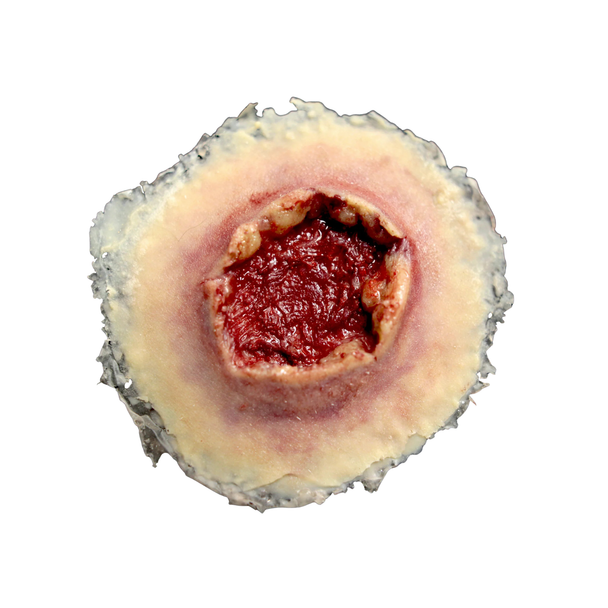 Techline Trauma Gunshot Exit Wound - Large